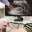 First Ultrasound Appointment